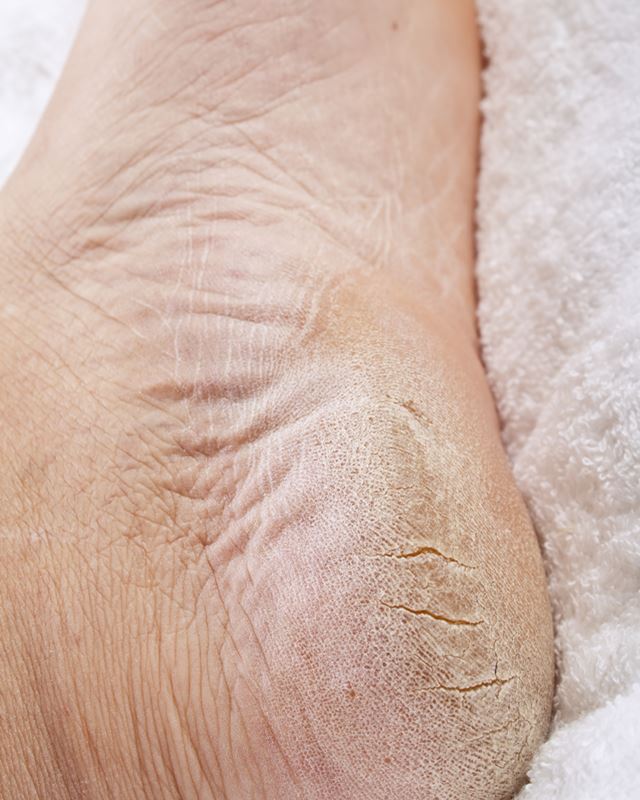 img-dmk-medipedi-foot-pedicure